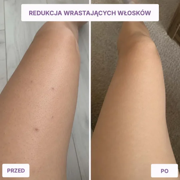 DovloSkin | Rękawica peelingująca