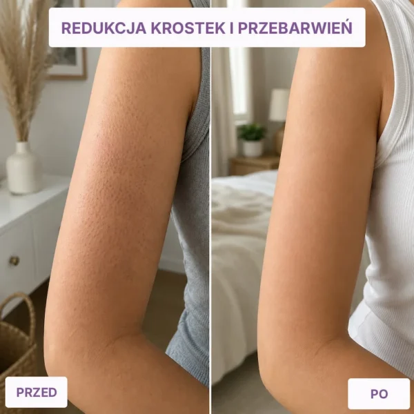 DovloSkin | Rękawica peelingująca